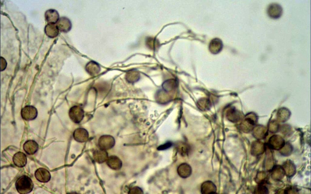 Non nivicolous Diderma